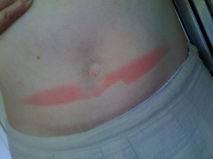Muffin Top Burn fail