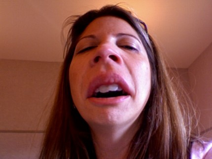 upnose