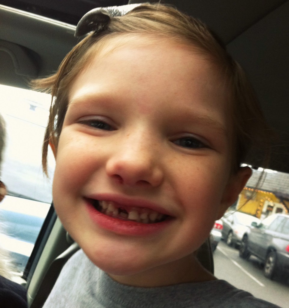 lost front tooth