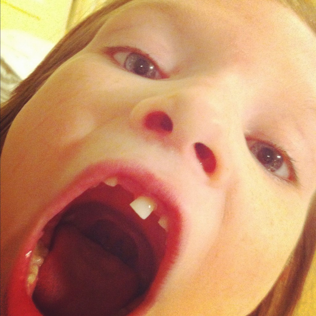 That stubborn tooth! That stubborn tooth!