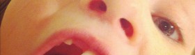 That stubborn tooth! That stubborn tooth!